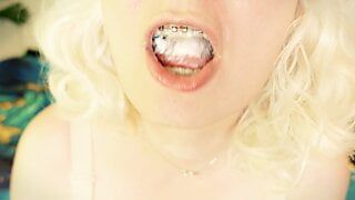 BRACES fetish – ASMR video of eating MUKBANG… food fetish