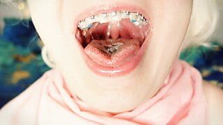 BRACES fetish – ASMR video of eating MUKBANG…