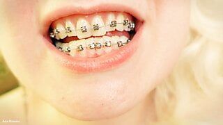braces mouth tour video – vore fetish