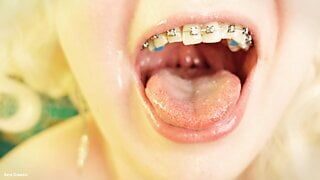 eating in braces – vore and food fetish – close up video